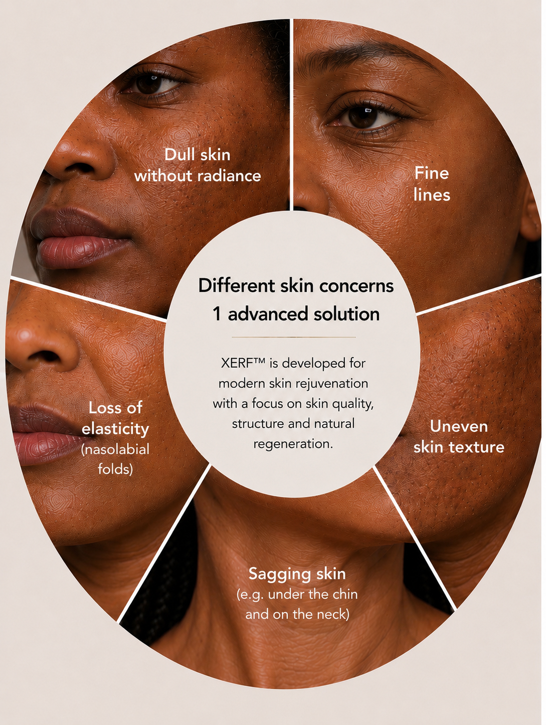 Detailed illustration showing common skin concerns in darker skin tones, fine lines around the eyes, loss of elasticity with nasolabial folds, and skin laxity beneath the chin and neck. XERF™ is presented as an advanced solution for modern skin tightening, improved skin quality, and natural skin regeneration.